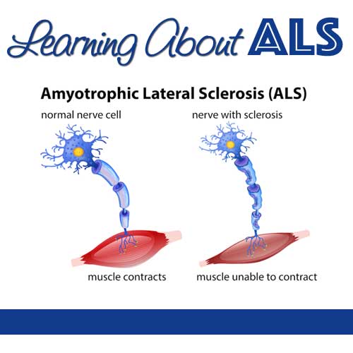 What is ALS? - Amyotrophic Lateral Sclerosis